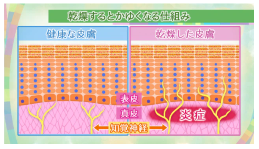 かゆみを感じる知覚神経